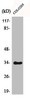 Western Blot analysis of COLO205 cells using Phospho-Cdk2/Cdc2 (T160) Polyclonal Antibody