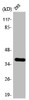 Western Blot analysis of 293 cells using 17β-HSD11 Polyclonal Antibody