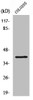 Western Blot analysis of COLO205 cells using ABHD6 Polyclonal Antibody