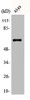 Western Blot analysis of Jurkat cells using AGBL4 Polyclonal Antibody