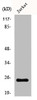 Western Blot analysis of Jurkat cells using AK5 Polyclonal Antibody