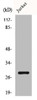 Western Blot analysis of Jurkat cells using Bcl-2 Polyclonal Antibody