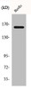 Western Blot analysis of HuvEc cells using Bcr Polyclonal Antibody