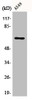 Western Blot analysis of A549 cells using E2F-1 Polyclonal Antibody