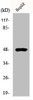 Western Blot analysis of COLO205 cells using E2F-2 Polyclonal Antibody