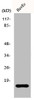 Western Blot analysis of HepG2 cells using eIF5A2 Polyclonal Antibody