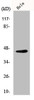 Western Blot analysis of HeLa cells using Elk-1 Polyclonal Antibody