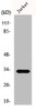 Western Blot analysis of HepG2 cells using ELOVL1 Polyclonal Antibody