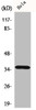 Western Blot analysis of HeLa cells using ELOVL4 Polyclonal Antibody