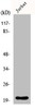 Western Blot analysis of HT29 cells using FGF-22 Polyclonal Antibody