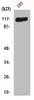 Western Blot analysis of 293 cells using Flg Polyclonal Antibody