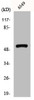 Western Blot analysis of A549 cells using GIPR Polyclonal Antibody