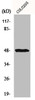 Western Blot analysis of COLO205 cells using IL-13Rα1 Polyclonal Antibody