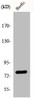 Western Blot analysis of HuvEc cells using KCNQ4 Polyclonal Antibody Western Blot analysis of HuvEc cells using KCNQ4 Polyclonal Antibody