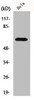 Western Blot analysis of HeLa cells using KOX11 Polyclonal Antibody