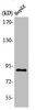 Western Blot analysis of HepG2 cells using M-cadherin Polyclonal Antibody