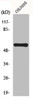 Western Blot analysis of COLO205 cells using MITF Polyclonal Antibody