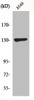 Western Blot analysis of A549 cells using Sin3B Polyclonal Antibody