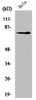 Western Blot analysis of HeLa cells using NGFR p75 Polyclonal Antibody