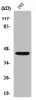 Western Blot analysis of A549 cells using NKp46 Polyclonal Antibody Western Blot analysis of A549 cells using NKp46 Polyclonal Antibody