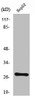Western Blot analysis of LOVO cells using NPDC-1 Polyclonal Antibody