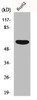 Western Blot analysis of 293 cells using OY-TES-1 Polyclonal Antibody