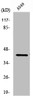 Western Blot analysis of Jurkat cells using PDHA1 Polyclonal Antibody