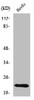 Western Blot analysis of HeLa cells using PEBP2β Polyclonal Antibody