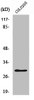 Western Blot analysis of COLO205 cells using PGLS Polyclonal Antibody