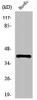 Western Blot analysis of Jurkat cells using pICln Polyclonal Antibody