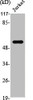 Western Blot analysis of Jurkat cells using SRE-ZBP Polyclonal Antibody