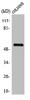 Western Blot analysis of COLO205 cells using TH Polyclonal Antibody