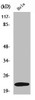 Western Blot analysis of K562 cells using UBE2T Polyclonal Antibody