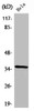 Western Blot analysis of HeLa cells using ZIS Polyclonal Antibody
