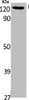 Western Blot analysis of Jurkat cells using UBE4A Polyclonal Antibody