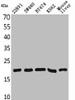 Western Blot analysis of 22RV-1 SW480 BT474 K562 mouse liver cells using VEGF-A Polyclonal Antibody