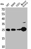 Western Blot analysis of U87 H460 U251 mouse brain cells using UCH-L1 Polyclonal Antibody