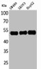 Western Blot analysis of SW480 SKOV3 HepG2 cells using c-FLIP Polyclonal Antibody