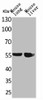 Western Blot analysis of mouse lung mouse liver cells using ALDH1A1 Polyclonal Antibody