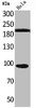 Western Blot analysis of HeLa cells using Trk C Polyclonal Antibody