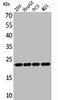 Western Blot analysis of 293 HepG2 PC-3 M21 cells using FGF-6 Polyclonal Antibody