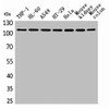 Western Blot analysis of THP-1 H460 A549 HT29 HeLa mouse kidney mouse colon cells using cPLA2 Polyclonal Antibody