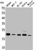 Western Blot analysis of SW480 MCF-7 HL-60 BT474 mouse colon cells using FGF-20 Polyclonal Antibody