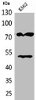 Western Blot analysis of K562 cells using HDC Polyclonal Antibody Western Blot analysis of K562 cells using HDC Polyclonal Antibody
