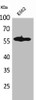 Western Blot analysis of K562 cells using Lyn Polyclonal Antibody