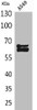Western Blot analysis of A549 cells using NUMB Polyclonal Antibody