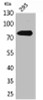 Western Blot analysis of 293 cells using Btk Polyclonal Antibody.