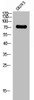 Western Blot analysis of SKOV3 cells using LIR-1 Polyclonal Antibody