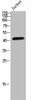 Western Blot analysis of JK cells using Phospho-NUDC (S326) Polyclonal Antibody Western Blot analysis of JK cells using Phospho-NUDC (S326) Polyclonal Antibody