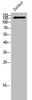 Western Blot analysis of Jurkat cells using STAG3 Polyclonal Antibody